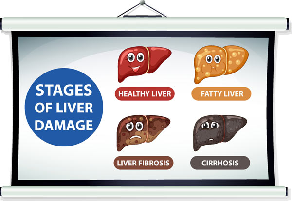 branched-chain amino acids for fatty liver, liver health